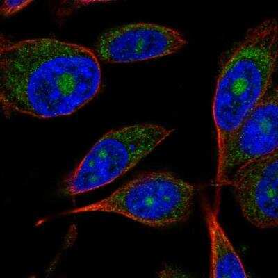 Immunocytochemistry/ Immunofluorescence: ARL9 Antibody [NBP2-49679]
