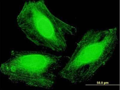 Immunocytochemistry/ Immunofluorescence: ARMC1 Antibody [H00055156-B01P]