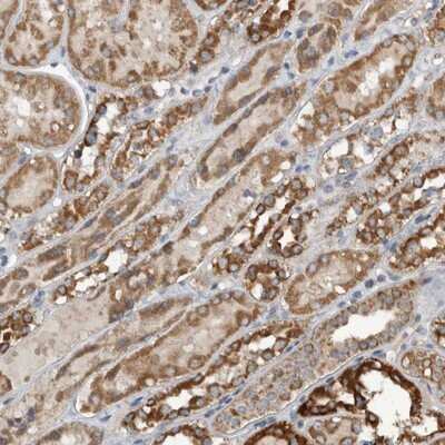 Immunohistochemistry-Paraffin: ARMC1 Antibody [NBP1-88847]