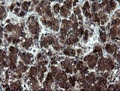 Immunohistochemistry: ARMC1 Antibody (OTI1D10) - Azide and BSA Free [NBP2-71989]