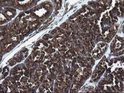 Immunohistochemistry: ARMC1 Antibody (OTI1D10) - Azide and BSA Free [NBP2-71989]