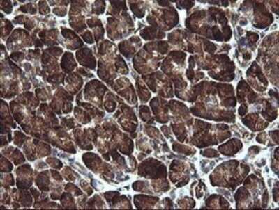 Immunohistochemistry: ARMC1 Antibody (OTI1D10) - Azide and BSA Free [NBP2-71989]