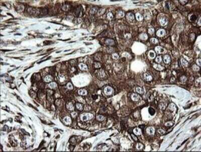 Immunohistochemistry: ARMC1 Antibody (OTI1D10) [NBP2-46543]