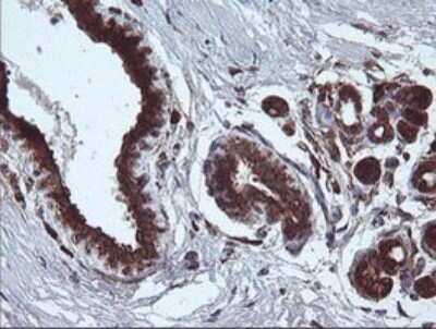 Immunohistochemistry: ARMC1 Antibody (OTI1D10) [NBP2-46543]