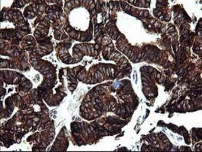 Immunohistochemistry: ARMC1 Antibody (OTI1D10) [NBP2-46543]