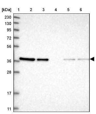 Western Blot: ARMC1 Antibody [NBP1-88847]