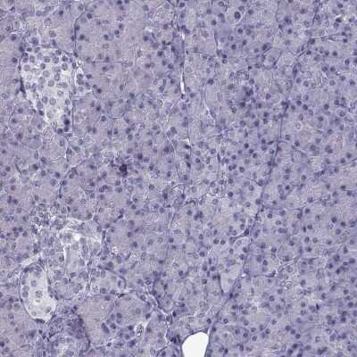 Immunohistochemistry-Paraffin: ARMC2 Antibody [NBP1-88730]