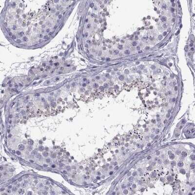 Immunohistochemistry-Paraffin: ARMC2 Antibody [NBP1-88730]