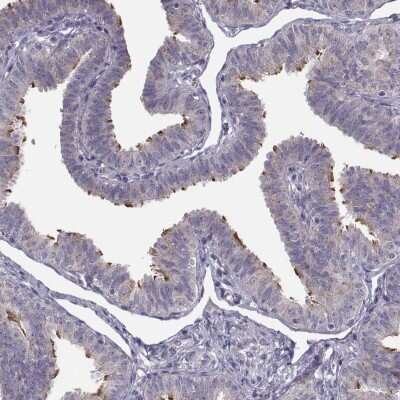 Immunohistochemistry-Paraffin: ARMC3 Antibody [NBP1-85394]