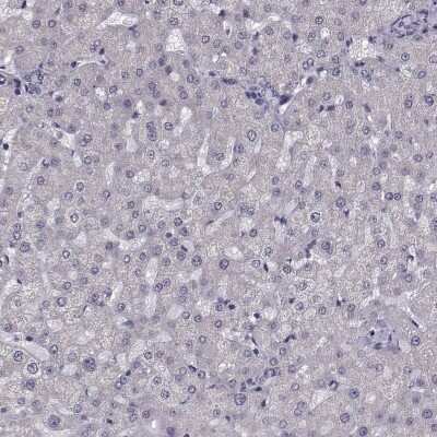 Immunohistochemistry-Paraffin: ARMC3 Antibody [NBP1-85394]