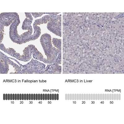 Immunohistochemistry-Paraffin: ARMC3 Antibody [NBP1-85394]