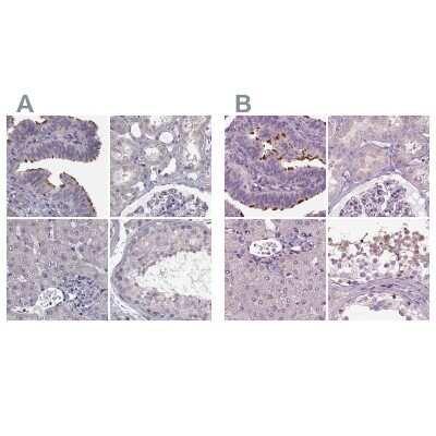 Immunohistochemistry-Paraffin: ARMC3 Antibody [NBP1-85394]