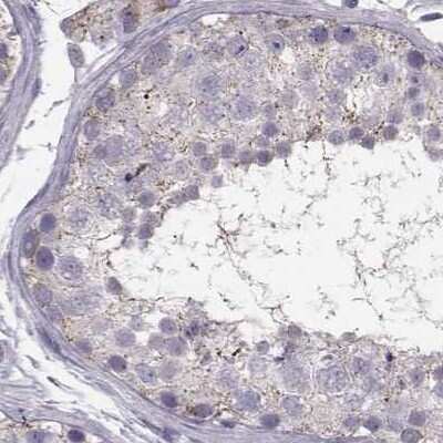 Immunohistochemistry-Paraffin: ARMC3 Antibody [NBP1-85394]