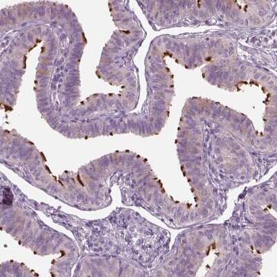 Immunohistochemistry-Paraffin: ARMC3 Antibody [NBP2-32703]