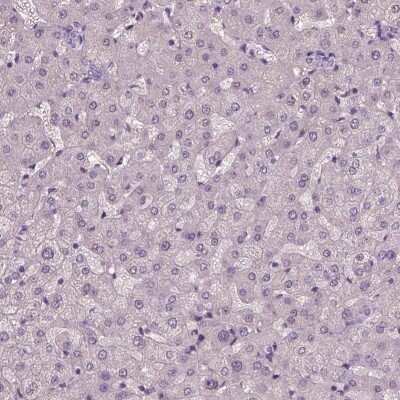 Immunohistochemistry-Paraffin: ARMC3 Antibody [NBP2-32703]