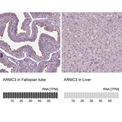 Immunohistochemistry-Paraffin: ARMC3 Antibody [NBP2-32703]