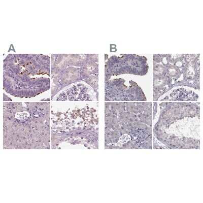 Immunohistochemistry-Paraffin: ARMC3 Antibody [NBP2-32703]
