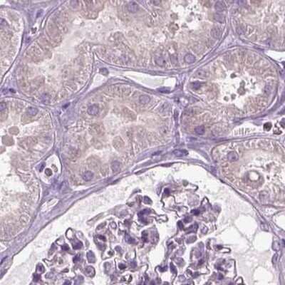 Immunohistochemistry-Paraffin: ARMC3 Antibody [NBP2-32703]