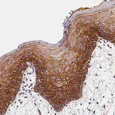 Immunohistochemistry-Paraffin: ARMC6 Antibody [NBP2-14317]