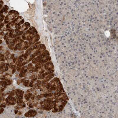 Immunohistochemistry-Paraffin: ARMC7 Antibody [NBP1-82129]