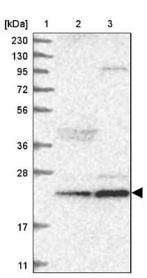 Western Blot: ARMC7 Antibody [NBP1-82129]