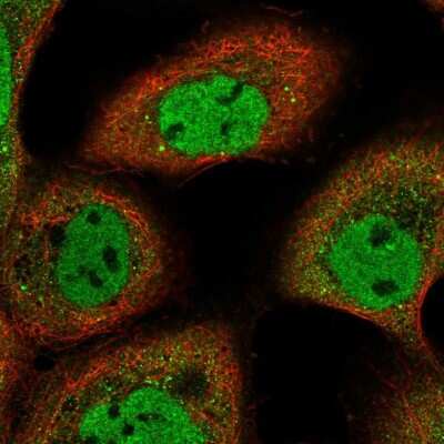 Immunocytochemistry/ Immunofluorescence: ARMC8 Antibody [NBP2-55188]