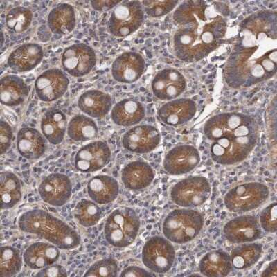 Immunohistochemistry-Paraffin: ARMCX1 Antibody [NBP1-89145]