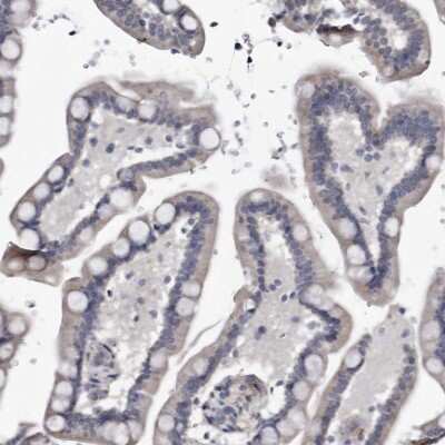 Immunohistochemistry-Paraffin: ARMCX2 Antibody [NBP1-89144]