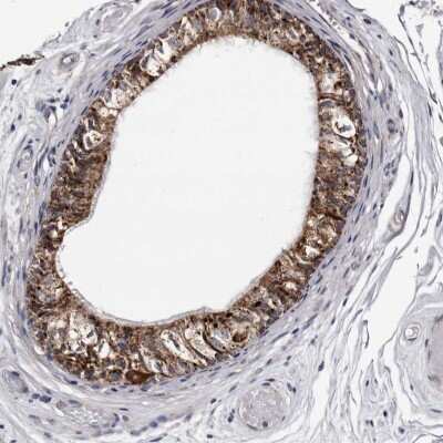 Immunohistochemistry-Paraffin: ARMCX2 Antibody [NBP1-89144]