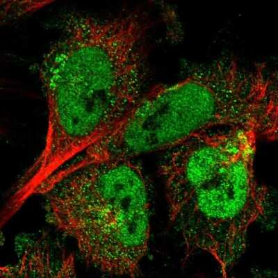Immunocytochemistry/ Immunofluorescence: ARMCX3 Antibody [NBP2-55606]