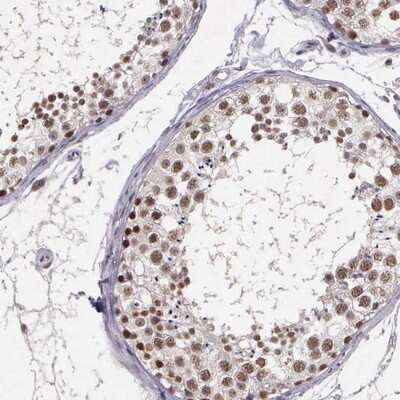 Immunohistochemistry-Paraffin: ARMCX5 Antibody [NBP1-82274]