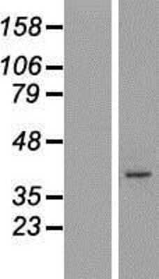 Western Blot: ARMCX5 Overexpression Lysate [NBP2-06400]