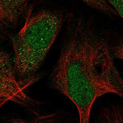 Immunocytochemistry/ Immunofluorescence: ARMCX6 Antibody [NBP2-30809]
