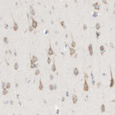 Immunohistochemistry-Paraffin: MANF Antibody [NBP1-90099]