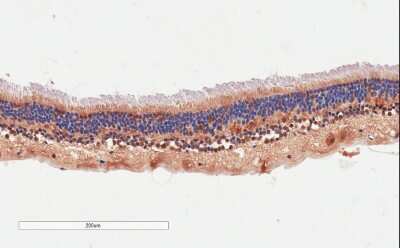 Immunohistochemistry-Paraffin: ARMS2 Antibody [NBP1-52157]