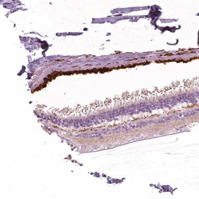 Immunohistochemistry-Paraffin: ARMS2 Antibody [NBP2-57920]