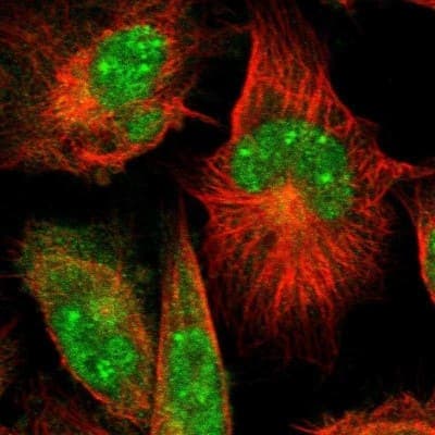 Immunocytochemistry/ Immunofluorescence: ARMT1 Antibody [NBP1-82277]