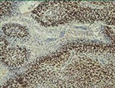 Immunohistochemistry: ARNT/HIF-1 beta Antibody (H1beta234) - Azide and BSA Free [NBP2-80582]