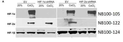 Western Blot: ARNT/HIF-1 beta Antibody (H1beta234)Azide and BSA Free [NBP2-80582]