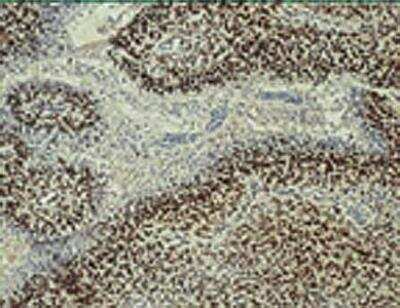 Immunohistochemistry: ARNT/HIF-1 beta Antibody (H1beta234) - BSA Free [NB100-124]