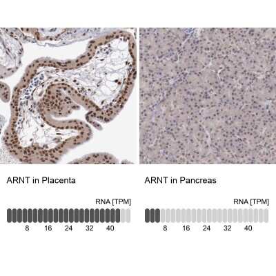 Immunohistochemistry-Paraffin: ARNT/HIF-1 beta Antibody [NBP2-54663]