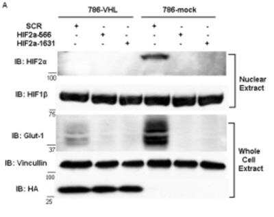 Western Blot: ARNT/HIF-1 beta Antibody Pack [NB100-982]