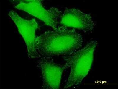 Immunocytochemistry/ Immunofluorescence: ARP10 Antibody [H00164668-B01P]