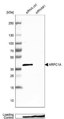 Western Blot: ARPC1A Antibody [NBP1-88851]