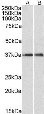 Western Blot: ARPC1A Antibody [NBP2-11579]