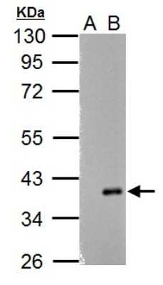Western Blot: ARPC1A Antibody [NBP2-15470]