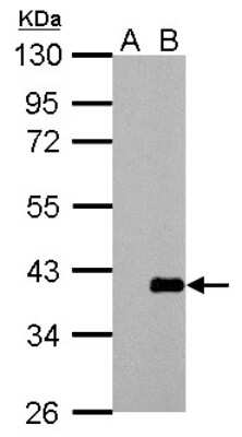 Western Blot: ARPC1A Antibody [NBP2-15471]