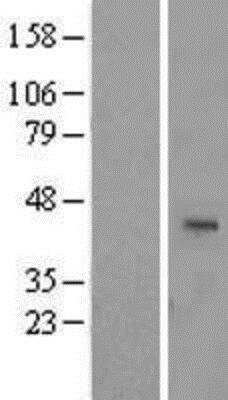 Western Blot: ARPC1A Overexpression Lysate [NBL1-07725]