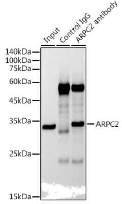 Immunoprecipitation: ARPC2 Antibody (4F2G6) [NBP3-15471]