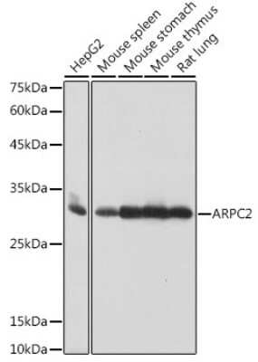 Western Blot: ARPC2 Antibody (4F2G6) [NBP3-15471]